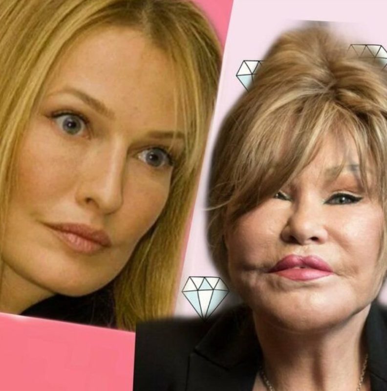 La trasformazione di Jocelyn Wildenstein Foto della splendida bellezza